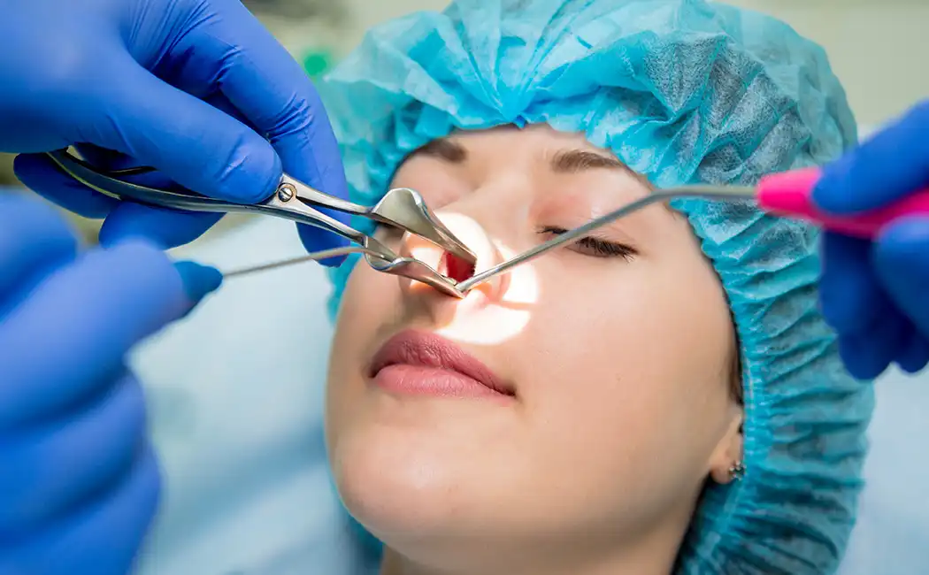 Endoskopik Sinus Cərrahiyyəsi (ESC)