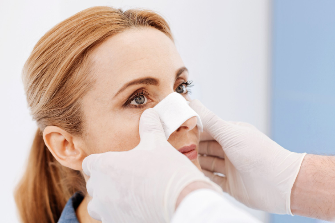 Rinoplastika əməliyyatından sonra ilk 6 ay 