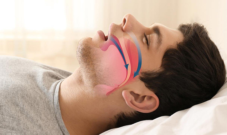 Xoruldama Nəyə Səbəb Olur? Xoruldama Necə Müalicə Edilir və Necə Müalicə Etmək Olar?